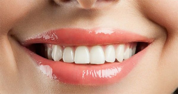 Bọc răng sứ có tác dụng gì