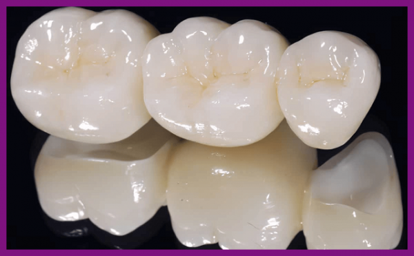 bọc răng sứ zirconia có tốt không?