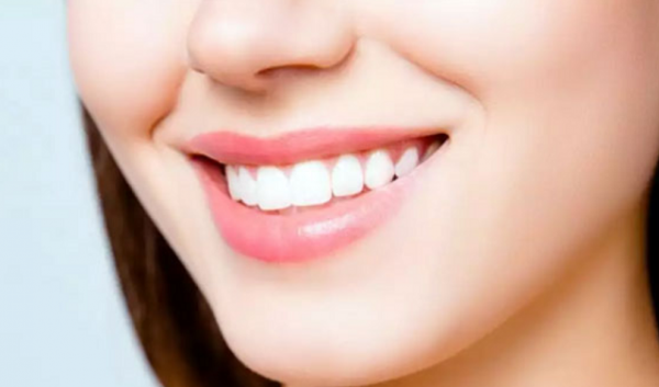 nên trồng răng sứ hay implant tốt