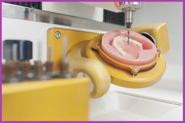 Công nghệ chế tác răng sứ CAD/CAM