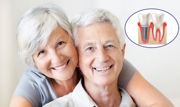 trồng răng implant cho người già