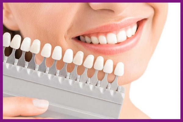 bọc răng sứ giúp hồi phục những răng bị khiếm khuyết