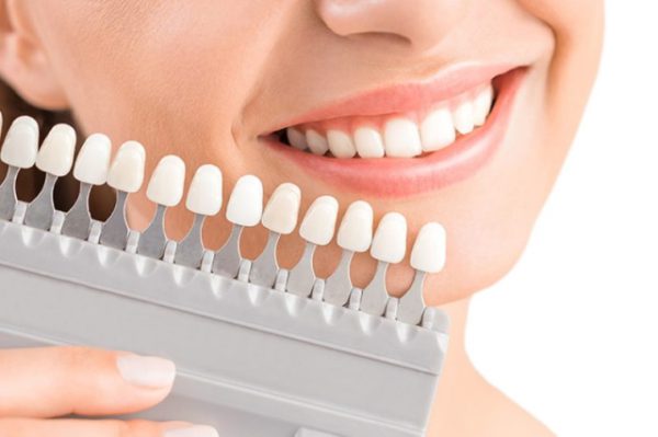 Bọc răng sứ có niềng răng được không?