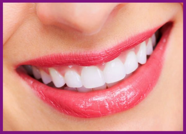 Răng implant mang lại nụ cười rạng rỡ, tự tin mỗi khi giao tiếp với người xung quanh