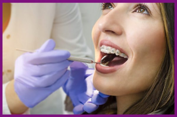 nên chọn cơ sở nha khoa uy tín để thực hiện niềng răng 1 hàm