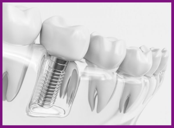 răng số 6 đóng vai trò chính trong việc thực hiện chức năng ăn nhai hằng ngày