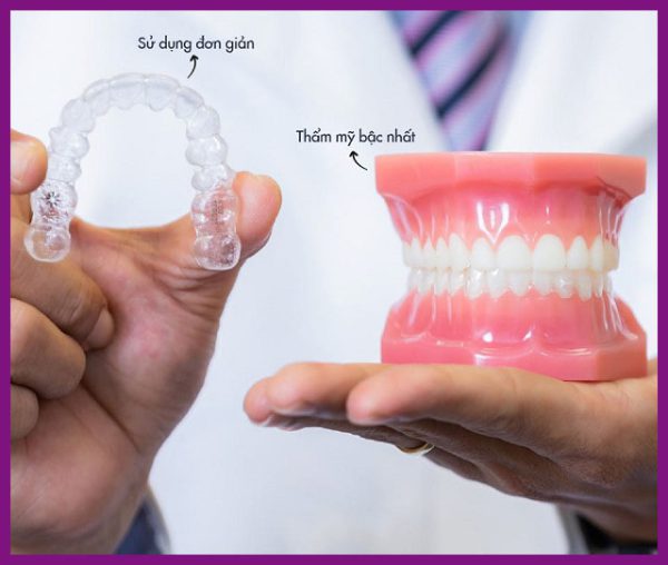 chỉnh nha trong suốt invisalign