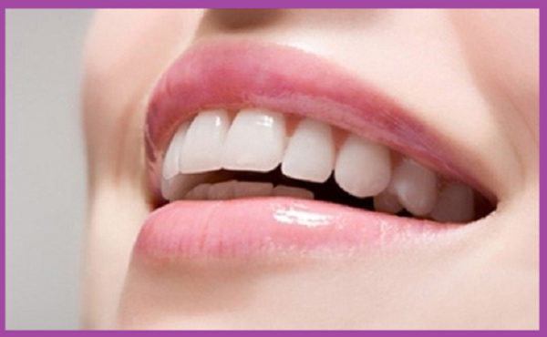 implant răng cửa xinh