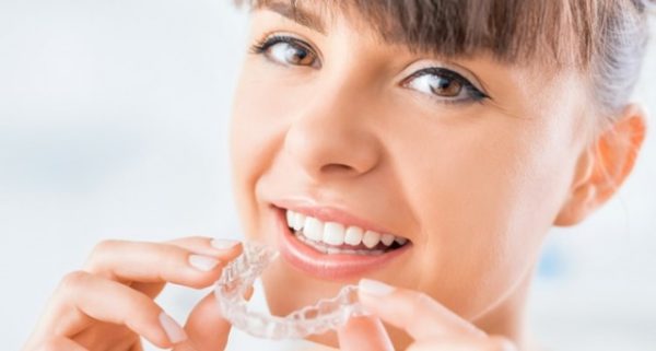 Niềng invisalign giá bao nhiêu?