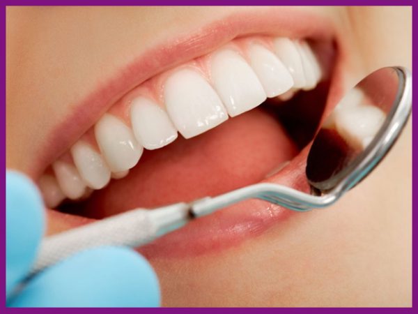 chi phí niềng răng mắc cài pha lê phụ thuộc vào tình trạng sức khỏe răng miệng của từng người