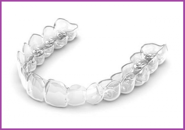 dịch vụ niềng răng trong suốt clear aligner