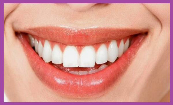 Phương pháp trồng răng implant bắt vít khắc phục hầu hết nhược điểm của phục hình dán xi măng