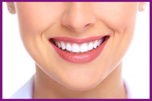 răng implant mang lại nụ cười đẹp