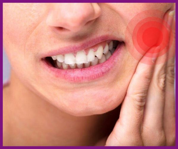 sâu răng có thể gây ra những cơn đau nhức khó chịu