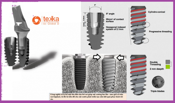 Thương hiệu trụ Implant Tekka