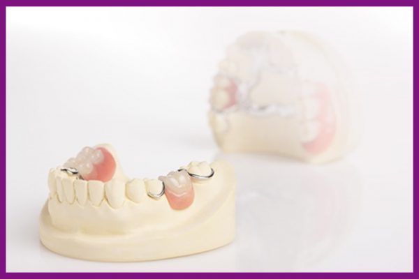 ảnh minh họa cấu tạo của răng hàm dưới