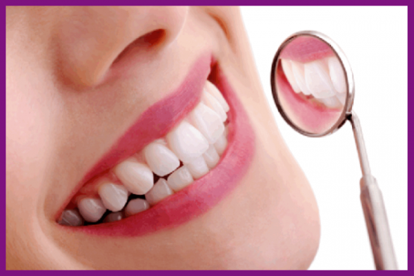 trồng răng implant là biện pháp phục hồi răng đang được ưa chuộng nhất hiện nay