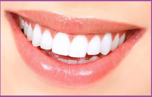 Trồng răng implant có niềng răng được không?
