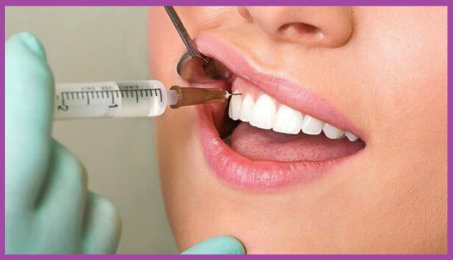 cách chữa viêm tủy răng tạm thời