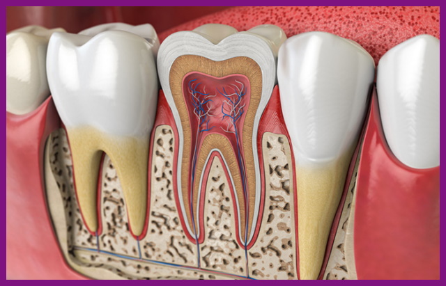 điều trị viêm tủy răng bao nhiêu tiền phụ thuộc vào phương pháp phục hồi răng sau lấy tủy