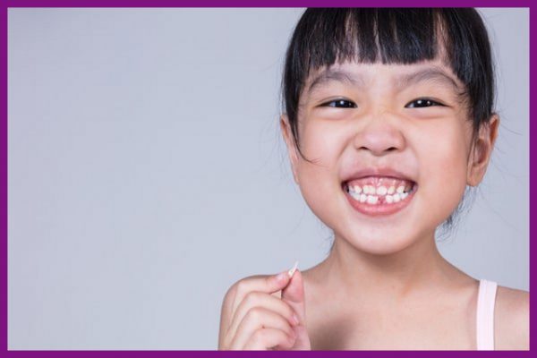 trẻ em thường dễ xuất hiện tình trạng răng mọc lệch lạc, lộn xộn
