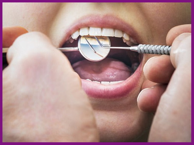 tủy răng bị viêm nhiễm, hư tổn cần được điều trị kịp thời tránh để lại hậu quả về sau