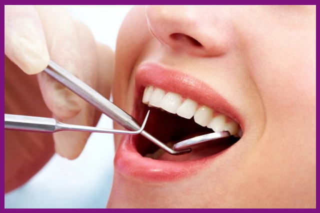 nhổ răng là biện pháp điều trị tủy răng bị viêm hiệu quả