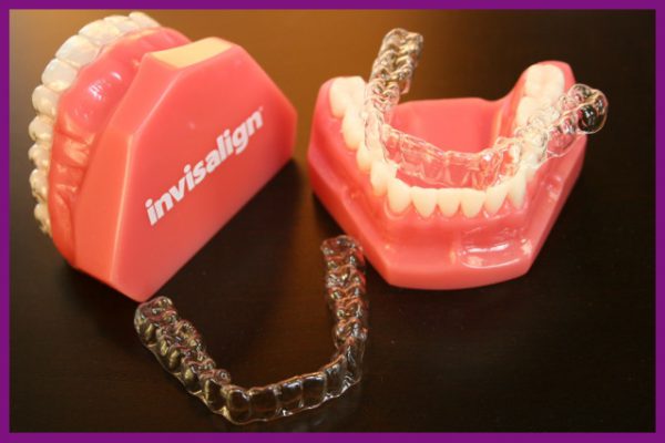 niềng răng invisalign là biện pháp chỉnh nha hiện đại, mang lại hiệu quả cao