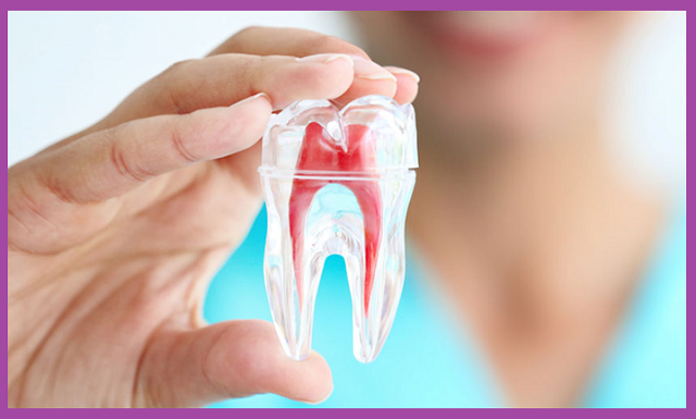 điều trị tủy răng hàm giá rẻ