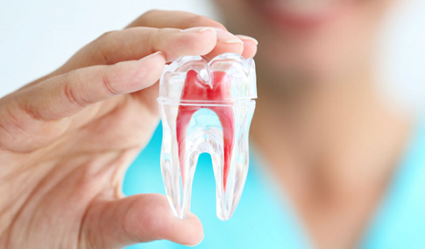 điều trị tủy răng hàm