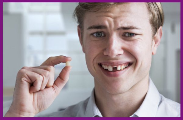 sai trình tự niềng răng có thể khiến răng chết tủy và bị rụng sớm
