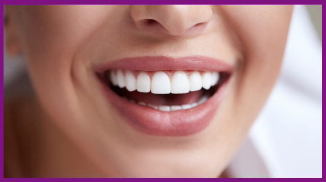 Hầu hết các nha khoa kim mã đều cho chất lượng dịch vụ tốt, mang lại hàm răng trắng sáng, đều đẹp