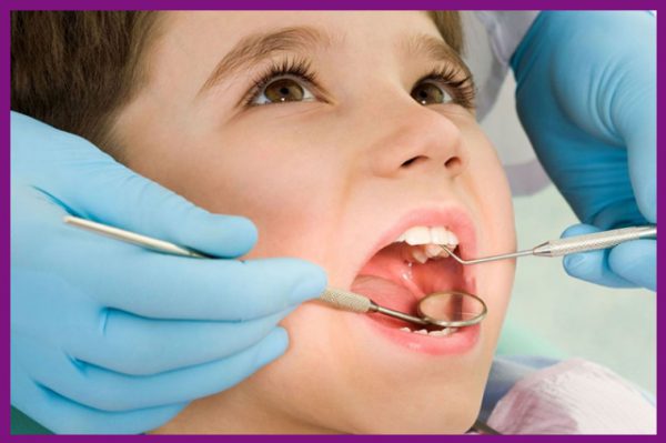khi răng của trẻ gặp vấn đề, phụ huynh cần lựa chọn niềng răng cho trẻ càng sớm càng tốt