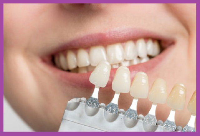 khai trương phòng khám nha khoa nụ cười xo ưu đãi phục hình răng
