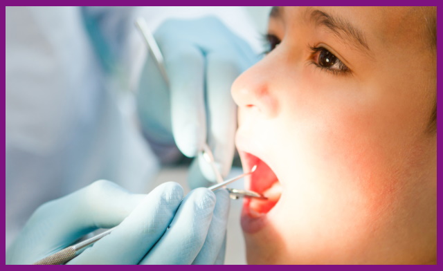 thời điểm nội nha tốt nhất là khi răng sữa ở trẻ trở nên lung lay, dễ gãy