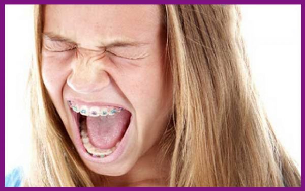 niềng răng vẫn có thể gây ra đau nhức khiến người bệnh khó chịu