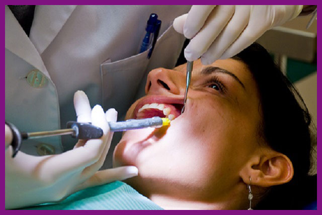 quy trình kỹ thuật điều trị tuỷ răng hiện nay