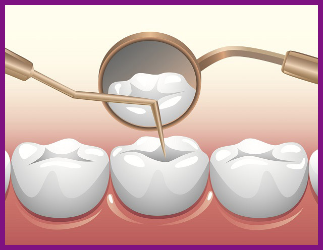 quy trình kỹ thuật điều trị tuỷ răng uy tín