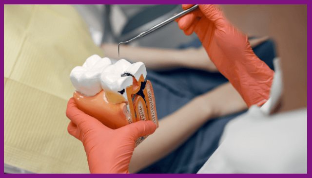tủy răng là phần nằm sâu bên trong răng