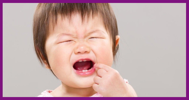 răng của trẻ rất yếu, rất dễ bị vi khuẩn xâm nhập gây viêm tủy răng