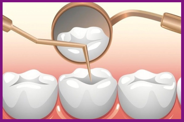 điều trị tủy răng sẽ giúp lấy sạch toàn bộ viêm nhiễm, loại trừ cơn đau nhanh chóng