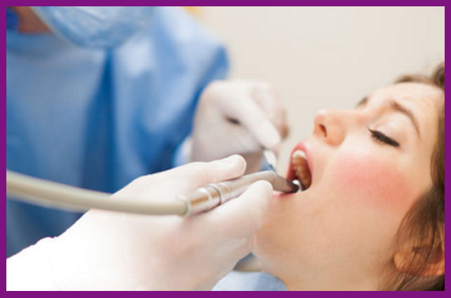 lấy tủy là biện pháp hàng đầu để chữa trị sâu răng viêm tủy