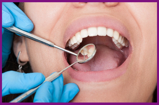 đi khám răng định kỳ sẽ giúp phát hiện được những dấu hiệu bất thường ở tủy răng
