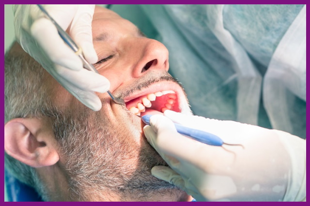 nhổ bỏ răng là biện pháp được thực hiện trong trường hợp răng bị viêm nặng