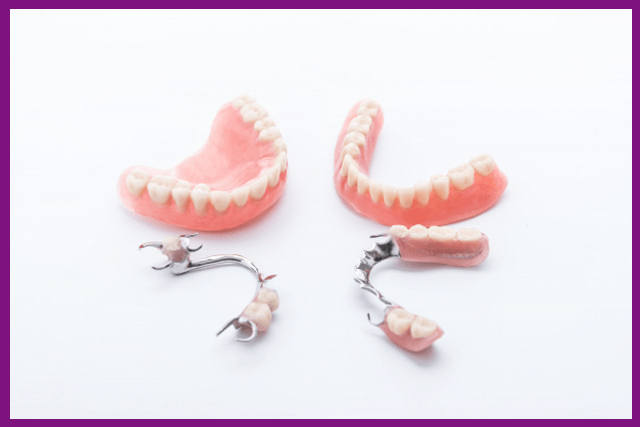 tài liệu phục hình sẽ cho bạn biết nên chọn loại hàm giả tháo lắp nào để phù hợp với tình trạng răng của mình