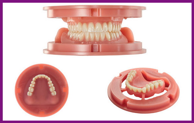 hàm giả tháo lắp toàn hàm là phương pháp phục hình răng nhanh chóng, mang lại thẩm mỹ tức thời cho người bệnh
