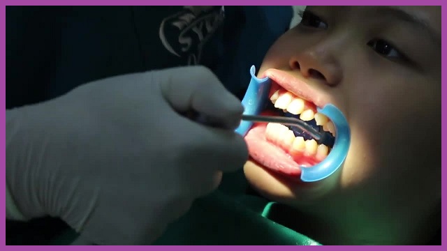 nhổ răng số 4 có ảnh hưởng gì không