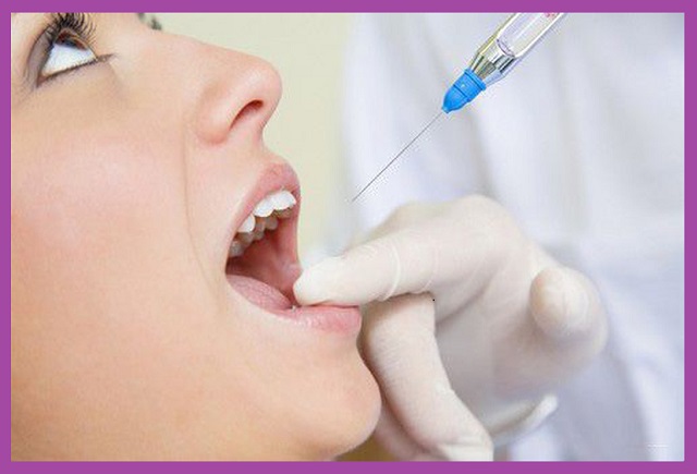 phòng ngừa tác dụng phụ của thuốc tê nhổ răng