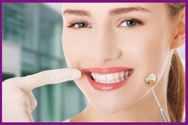 thẩm mỹ răng sẽ giúp khuôn miệng của bạn ngày càng đẹp hơn