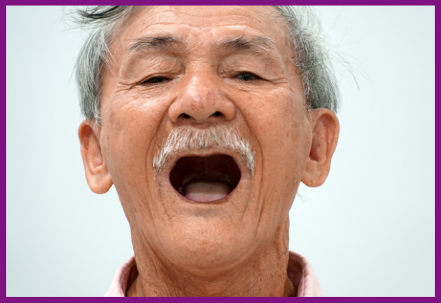 phục hình tháo lắp toàn hàm thích hợp với người cao tuổi bị mất răng toàn hàm